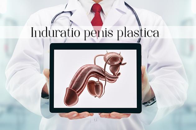 Induratio penis plastica, nuove possibilità terapeutiche