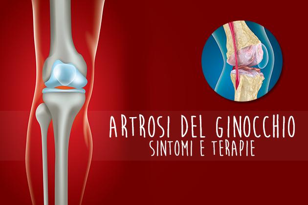 Artrosi del ginocchio: sintomi e terapie