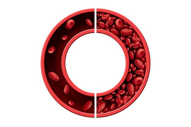 Emoglobina: cos'è e come viene misurata