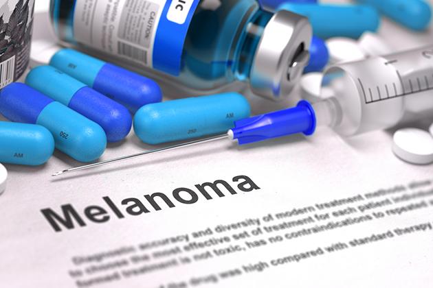 Viagra e rischio melanoma