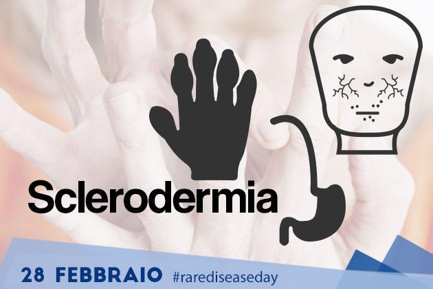 Sclerodermia, cos'è e quali sono i sintomi iniziali?
