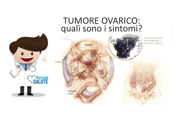 Tumore ovarico, i sintomi da non trascurare