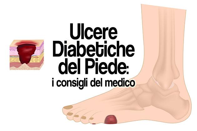 Ulcere diabetiche del piede: un problema molto comune
