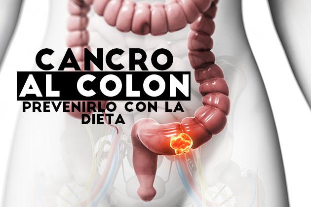 Cancro del colon: prevenirlo con la dieta