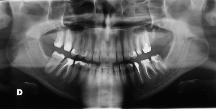 Dentista e paziente: un caso tipico di incomprensione