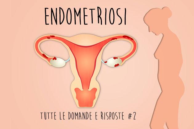 Endometriosi: tutte le domande e le risposte (seconda parte)
