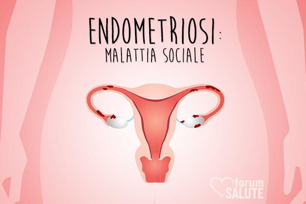 L'endometriosi come patologia sociale