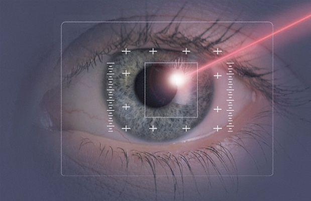 La correzione dei difetti di vista con il laser