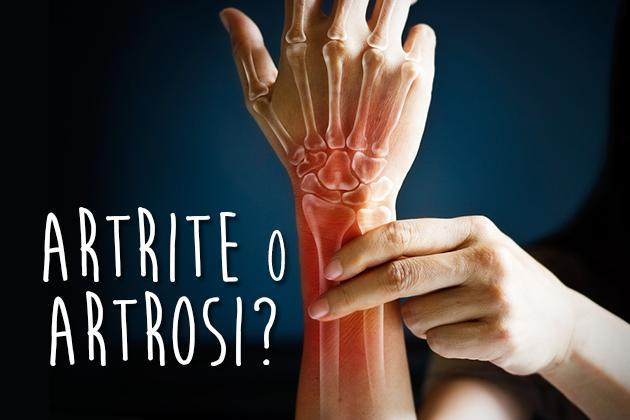 Artrosi o artrite? Ecco le differenze