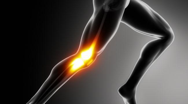 Artrosi del ginocchio: sintomi e terapie