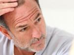 Serenoa repens: è efficace contro la caduta capelli?