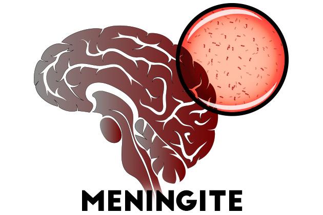 Meningite: sintomi e cure di una malattia che fa paura