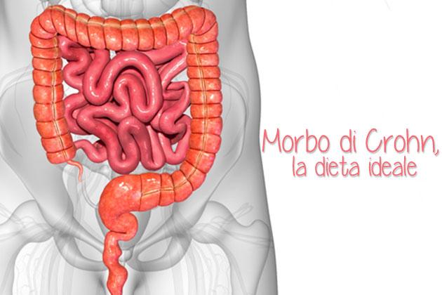 Morbo di Crohn, la dieta ideale