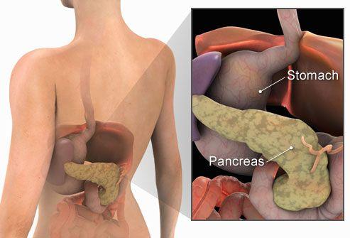 Pancreatite cronica: sintomi, cause e dieta da seguire