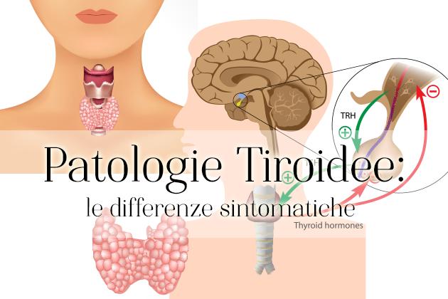 Ipotiroidismo, ipertiroidismo e patologie tiroidee