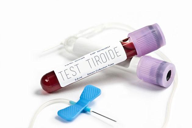 Gli esami del sangue per capire se la tua tiroide sta bene