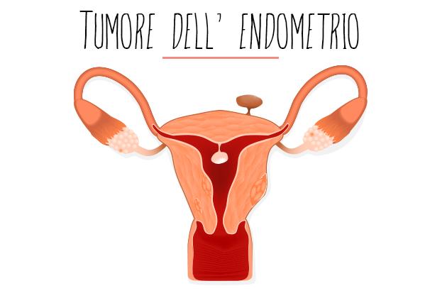 Tumore dell’endometrio: conoscerlo per affrontarlo meglio